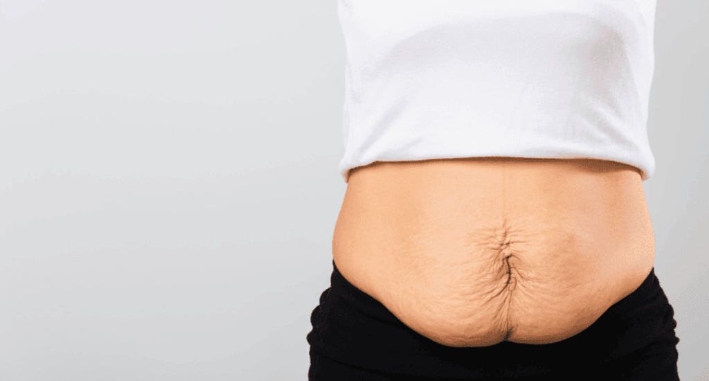 Bauchfett Perimenopause